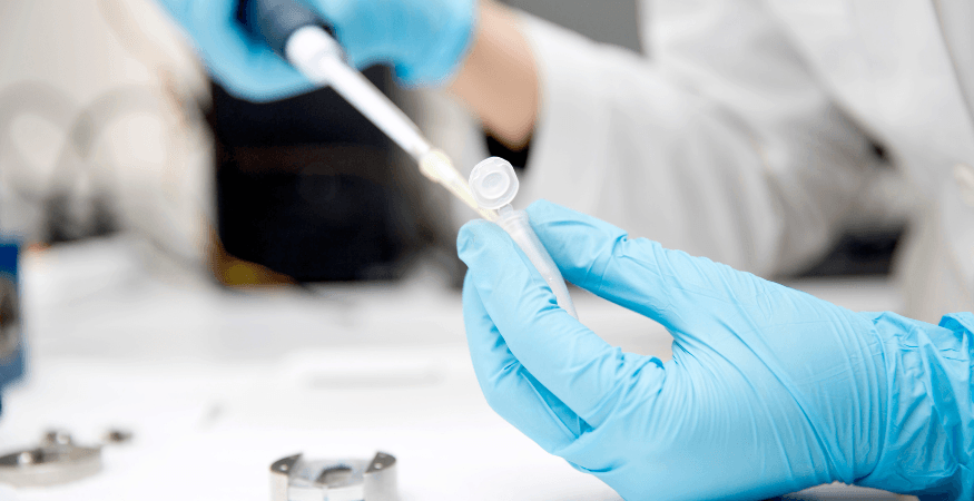 person-filling-up-test-tube-with-pipette