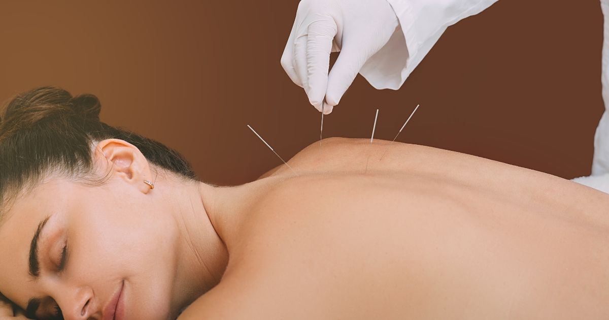 acupuncture-back.jpg