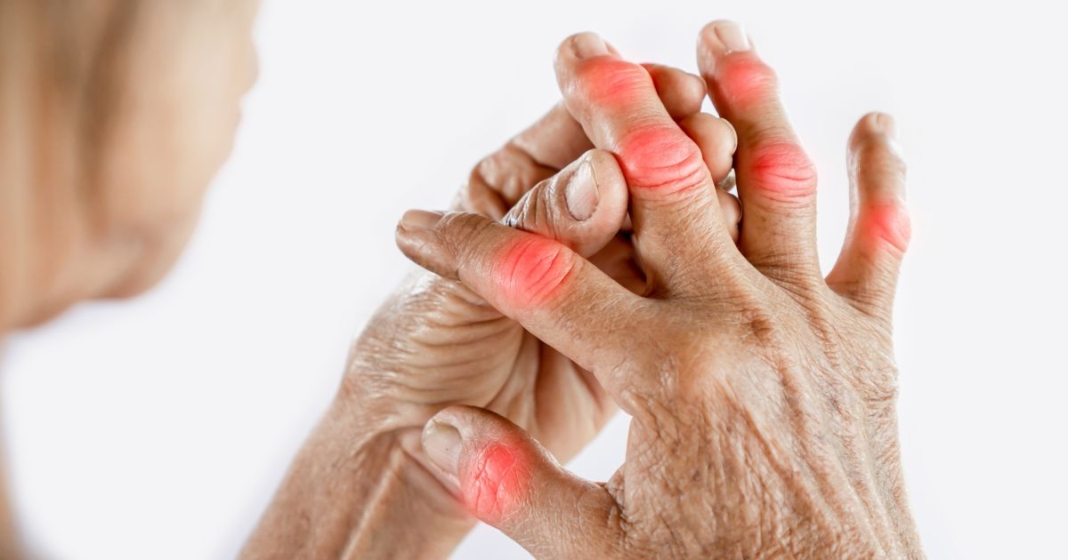 Woman grasping inflamed joints
